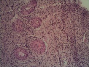 histologiczny-obraz-jajnika-klaczy