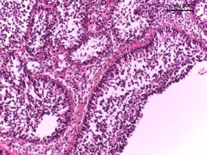 histopatologiczny-obraz-ziarniszczaka-jajnika-u-klaczy