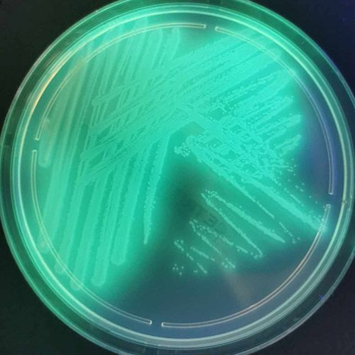 pseudomonas-aeruginosa-zdj-1
