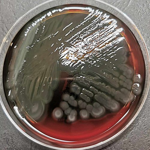 pseudomonas-aeruginosa-zdj-3